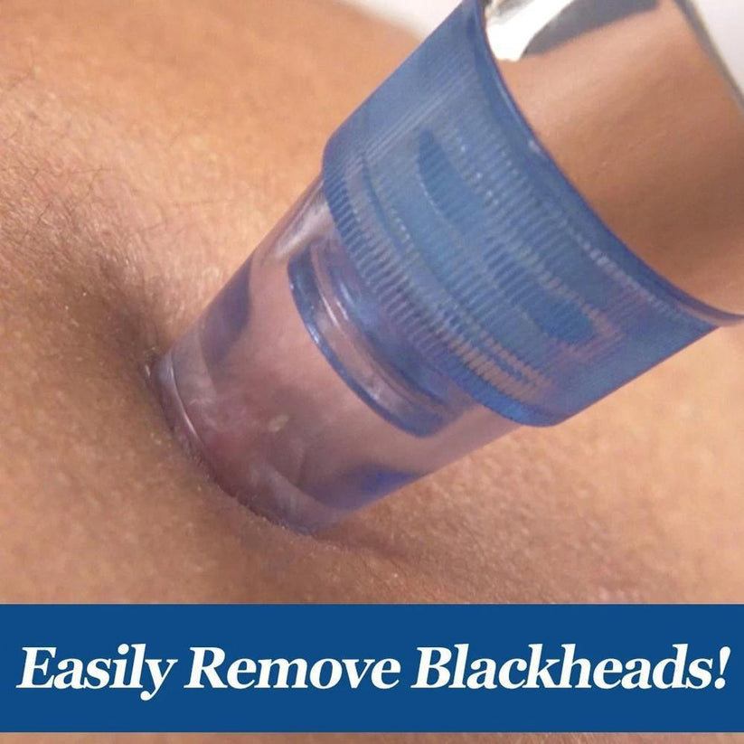 Corvio Blackhead Remover