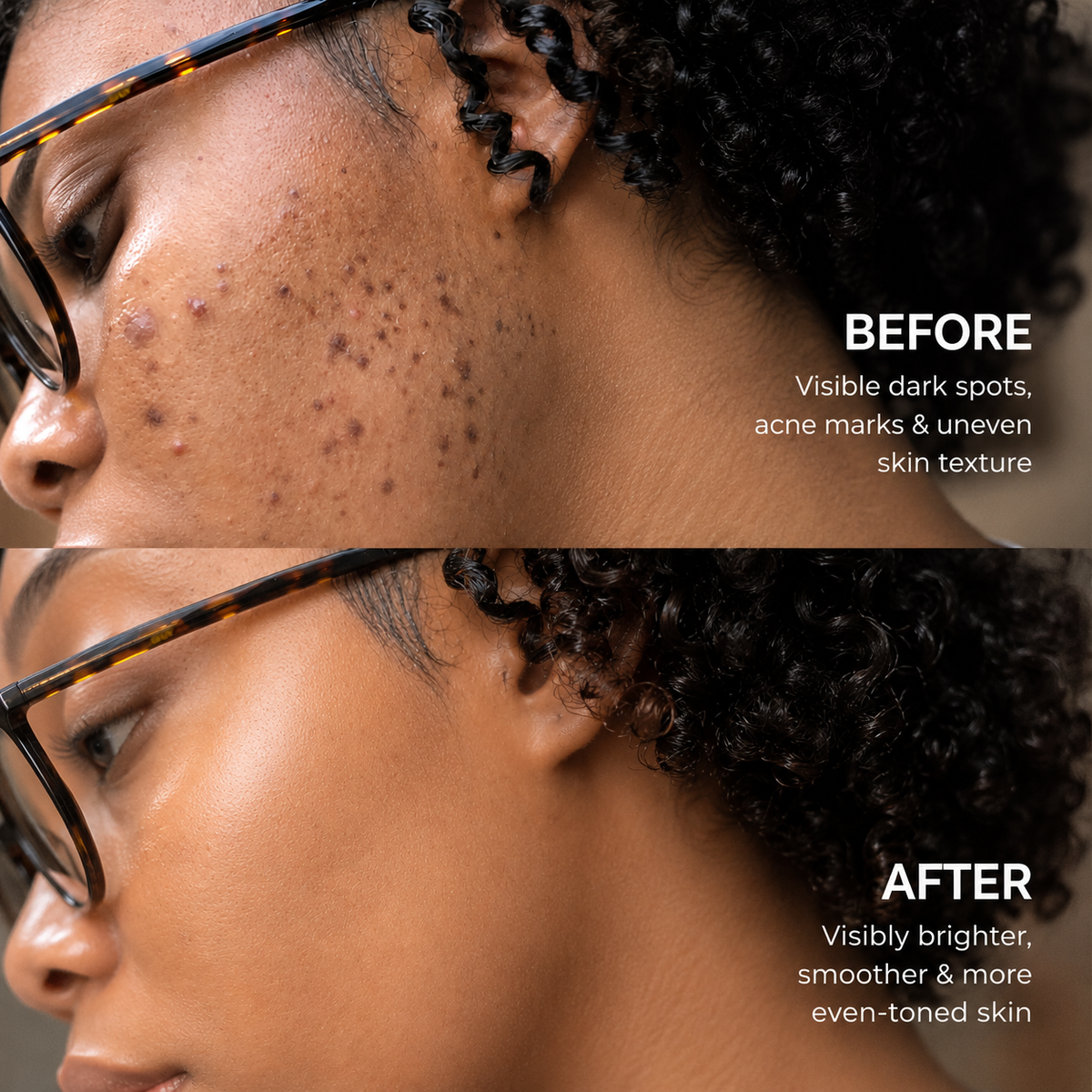 Korean Advanced Tranexamic Acid Brightening Cream